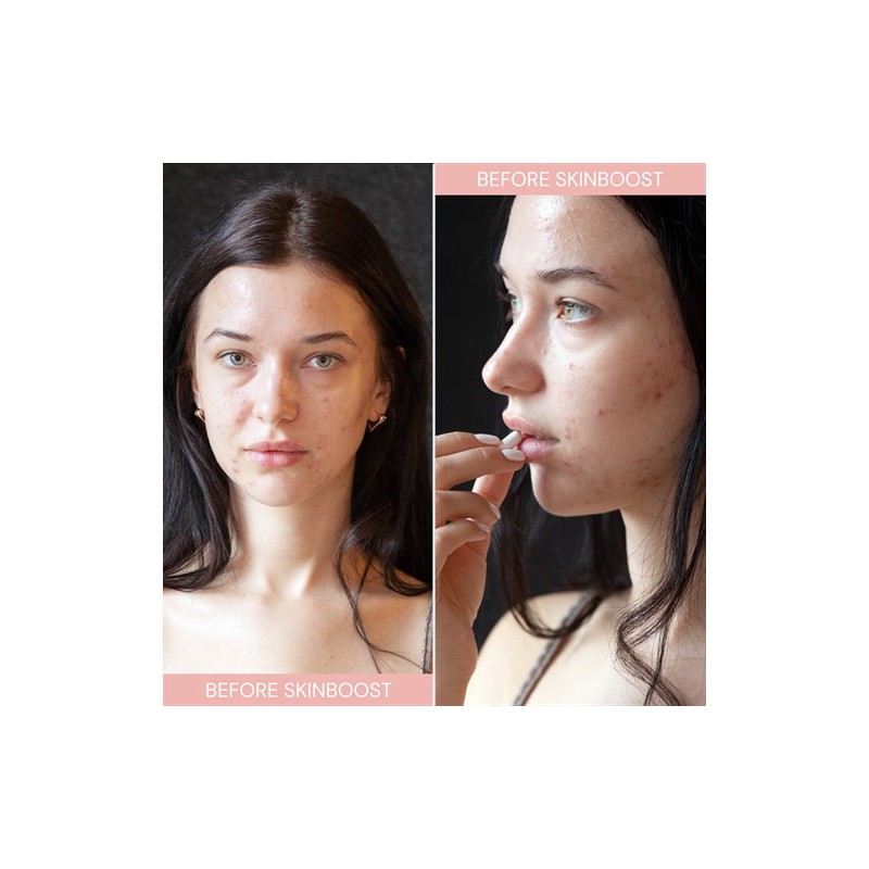 INSTALASH SkinBOOST 60 kapsalar